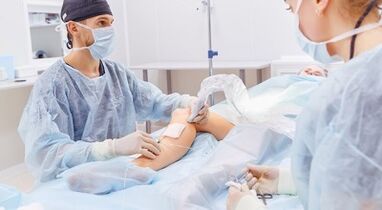 Operation for varicose veins