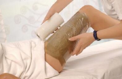 Vinegar wraps have proven effective for varicose veins on the legs