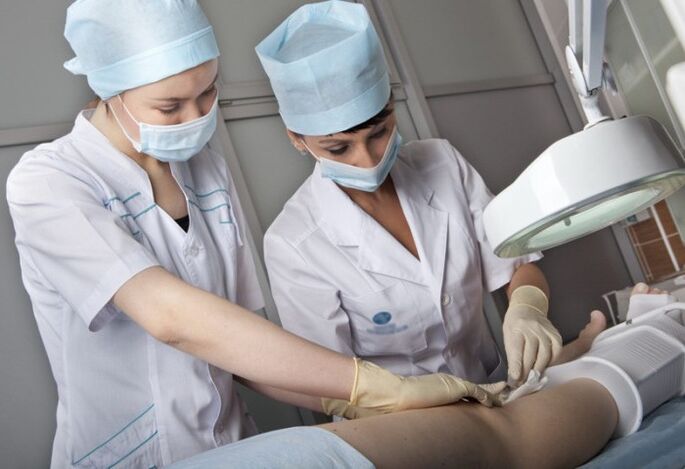 Carrying out surgery for varicose veins on the legs