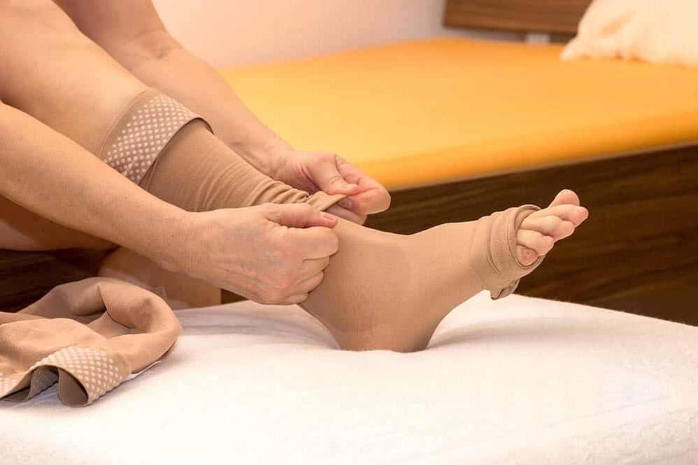 The use of compression stockings helps to relieve the manifestations of varicose veins. 